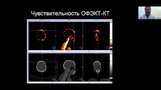 Сухов В.Ю. ОФЭКТ/КT современный бренд клинической ядерной медицины