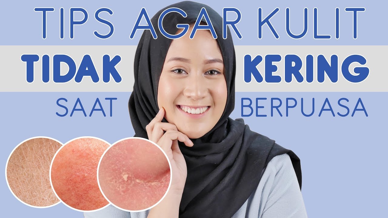 Kulit Kering Saat Berpuasa ? Begini Cara Mengatasi Kulit Kering Saat ...