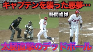 終盤でまさかのアクシデント…野間峻祥の太ももに死球でベンチから戻らず…【広島東洋カープVS阪神タイガース】