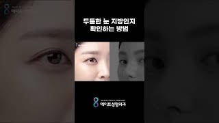 두툼한 눈 지방인지 확인하는 방법