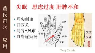 1.4 思虑过度失眠  开四关 刺间谷 | 董氏奇穴 实战应用 |  Master Tung Acupuncture Points