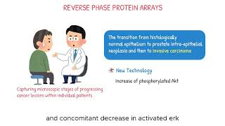 Reverse Phase Protein Arrays