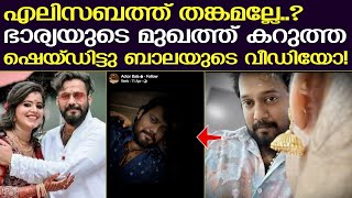 എലിസബത്തിന്റെ മുഖത്ത്‌ കറുത്ത ഷെയ്ഡിട്ടു ബാലയുടെ വീഡിയോ | Bala Actor | Elizabeth Bala