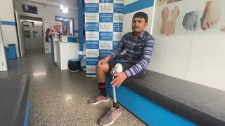 07835880155 - Bihar , Patna || above knee prosthesis | Op4 knee joint with aspire foot