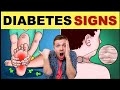 10 Diabetic Kidney Disease Symptoms You Should Know