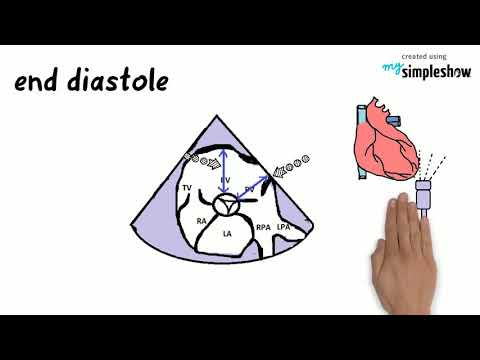 Heart Techy Right Ventricular Size And Function In Echo Part 1 Youtube