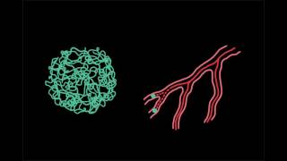 Science of Stall Catchers: Do stalls co-occur with amyloid plaques?