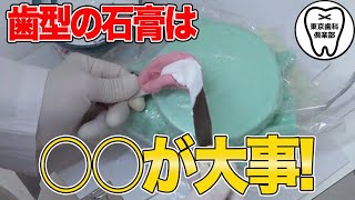 歯型に流し込む石膏は〇〇が大切！