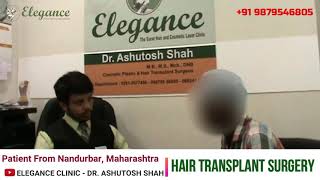 Nandurbar,Maharashtra Patient Review for Hair Transplant Surgery