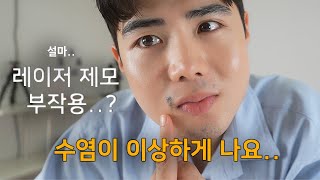 수염 레이저 제모 6회차 후기 (feat.현존 최고의 제모 기계)