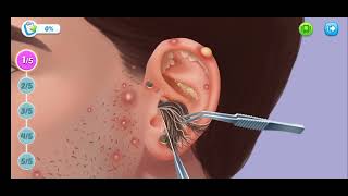 Ear Cleaning and Treatment ASMR Video| MA Gaming