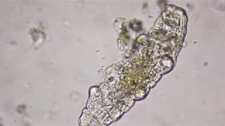 Tardigrade @ 400x magnification