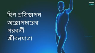 হিপ প্রতিস্থাপন অস্ত্রোপচারের পরবর্তী জীবন