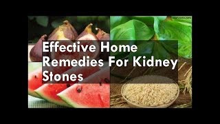 How to treat Kidney Stones and UTI by Doc Willie Ong and  Doc Jonathan Hoops Noble