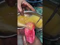 what’s inside hydrocele sac operation hydrocil treatment i india i surgery i hydrocelectomy