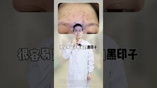 脸上疙疙瘩瘩❗️1招变光滑，低成本技巧闭口 闭口粉刺 护肤 油皮