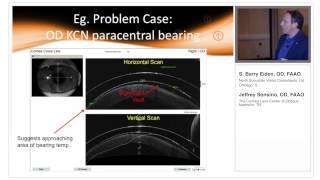 Anterior Segment OCT for the Specialty Lens Fitter Part 2