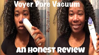 Skin Vacuum: Blackhead Removal| Voyor Pore Vacuum| Demo/Review