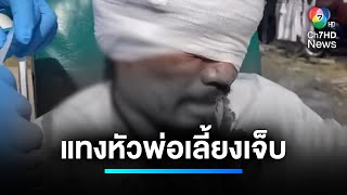 ลูกเลี้ยงโหด ! แทงหัวพ่อเลี้ยง เหตุน้ำมันทอดไข่ | เจาะประเด็นข่าว 7HD