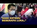 [FULL] Keterangan Dokter Usai Otopsi Ulang Brigadir J, Temukan Beberapa Luka