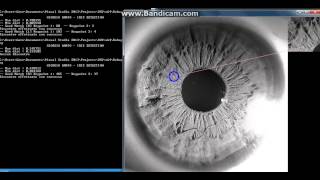 Iris detection OpenCV
