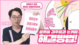 쌍꺼풀 겹주름과 눈꺼짐 해결 방법은 무엇일까