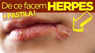 De ce facem HERPES: 5 cauze + PASTILA pentru Herpes