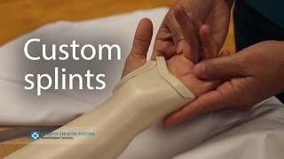 Occupational therapy: Custom splints