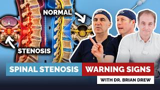 Legs Feel Sore, Heavy Or Dead? Maybe You Have Spinal Stenosis. Spine Surgeon Explains