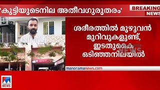 തലയിൽ ഗുരുതര ക്ഷതം; ഇടതു കൈ ഒടിഞ്ഞു; കുട്ടിയുടെ നില അതീവഗുരുതരം | Kochi