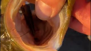 Best Way To Remove A Gut Hook (Swallowed hook)
