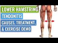 Three Simple Distal Hamstring Tendinopathy Exercises