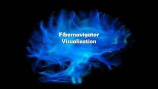 Fibernavigator visualization