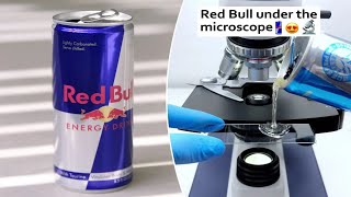 Microscope reveals what's really inside Red Bull