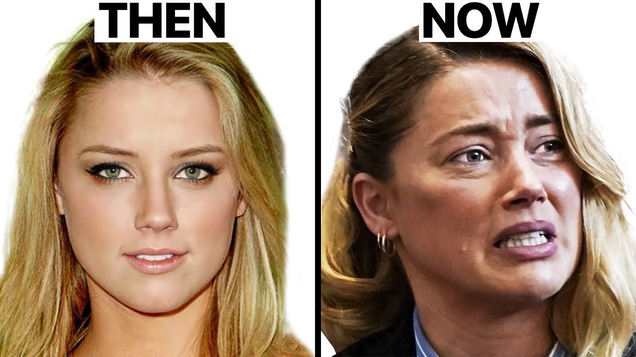 Amber Heard’s New Look - Plastic Surgery Analysis - YouTube