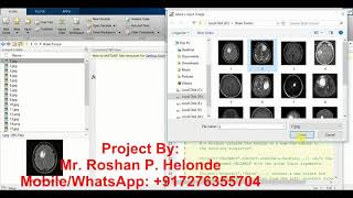 Matlab Source Code for Brain Tumor Detection Using Image Processing