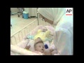 Conjoined twins in Cairo prepared for Texas operation