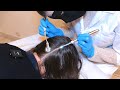 ASMR 1 HOUR of Medical SCALP Exams Compilation 🤍 (Real Person)