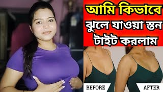 ঝুলে যাওয়া স্তন টাইট করার নিয়ম/ঝুলে যাওয়া বেস্ট ঠিক করার উপায়/Breast tightening cream