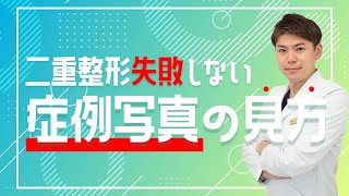 二重整形【失敗】しない為の症例写真の見方★美容整形のベテランはこうしてる！13年目の高川が教えます★