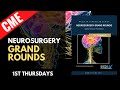 Anatomy Guided Microneurosurgery for the Removal of Lobar Gliomas by Guilherme Carvalhal Ribas, MD