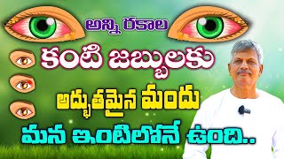 A wonderful remedy for all types of eye diseases | B. Anjaneya Raju garu | #SreeArogyaSannidhi