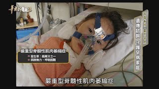 遺傳諮詢 守護罕病家庭 單元4｜因為有你 愛不罕見｜華視新聞雜誌 EP2225｜2020.06.05