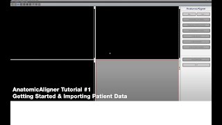 AnatomicAligner Tutorial #1: Navigation & Importing Patient Data