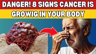 Don’t Miss These 8 Early Cancer Signs - It Could Save You