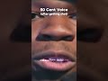 50 Cent's voice Before and After *getting shot*🔫  #rap #realrap #50cent