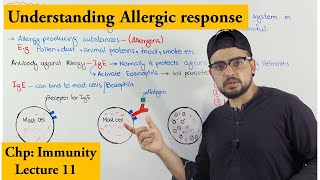Allergy or Hypersensitivity