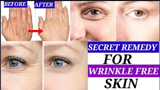 Remove Wrinkles from Hands \u0026 Face । হাতের কুচকানো ভাব টানটান করতে নিজেই ঘরে তৈরি করে নাও এই ক্রিম।