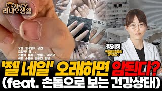 [슬라생] '젤 네일' 오래하면 암된다? 전문의 \