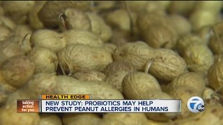 New study: Probiotics may help prevent peanut allergies in humans